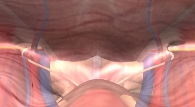 Hernia inguinal laparo-endoscópica. Anatomía inguinal aplicada en modelo 3D
